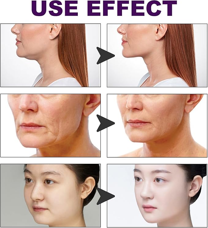 Cinta invisible de Estiramiento Facial